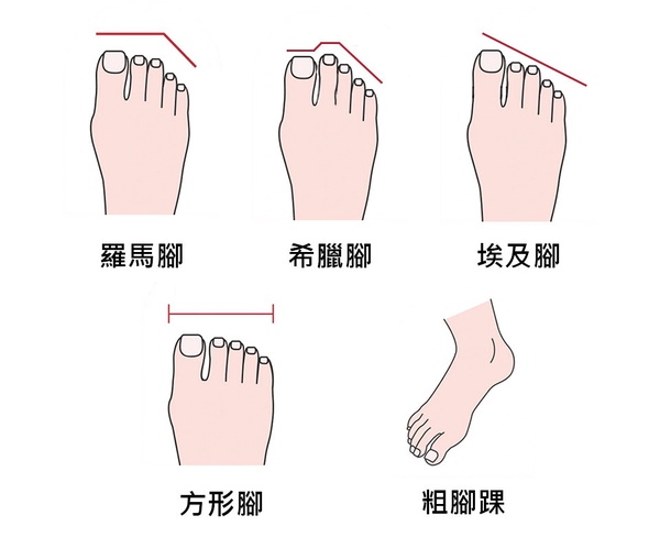 不同腳型挑選涼鞋技巧！寬大腳板、胖腳踝救星是這款，挑對命定鞋款一整天舒適無負擔