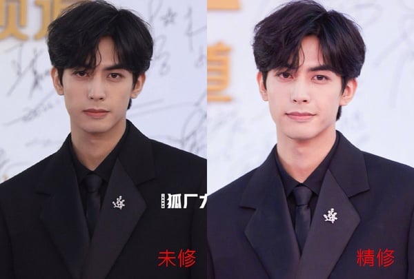 金雞獎16位明星「精修vs.未修」!王鶴棣&沈月同框,楊穎&倪妮美翻,陳妍希卻成了災難