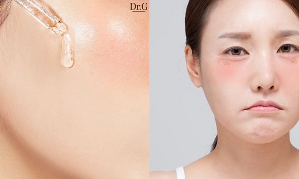 敏感肌必看!敏感肌保養「修護型乳液」推薦,搭配護理Tips提升肌膚防禦力