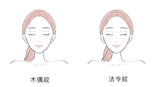 木偶紋是什麼？消除木偶紋的5個保養對策、成因與預防方法