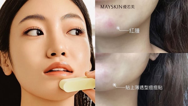 上妝不卡粉痘痘貼推薦!掌握關鍵兩步驟,痘痘秒神隱、上妝不卡粉
