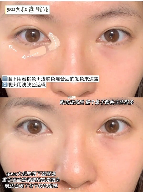 3大黑眼圈淚溝遮瑕法！適合族群全解析