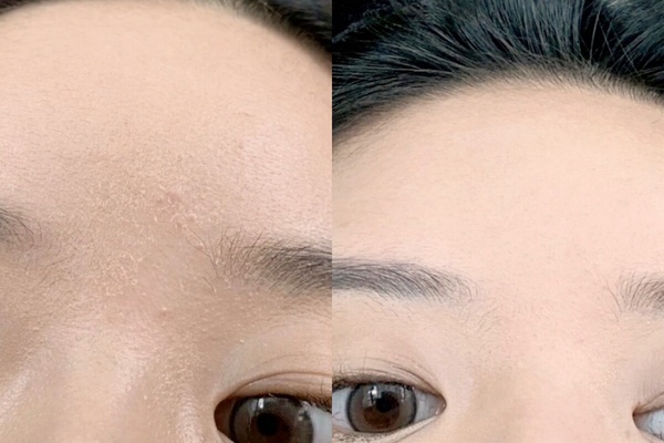 夏季底妝局部起皮原因+解法