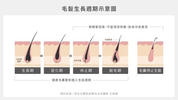 頭髮一直掉怎麼辦?夏季養髮必知!頭皮清潔、造型品後要用潤髮乳洗頭