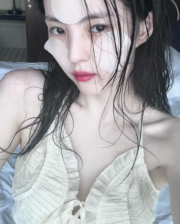 拯救髮際線！髮際線後退怎麼辦？