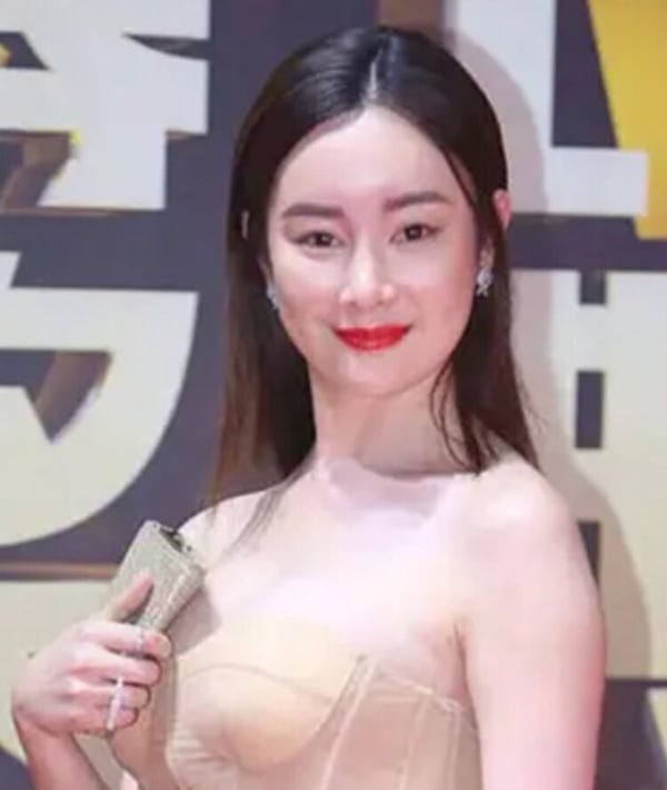 8位被質疑動臉的女星對比照!趙露思大方回應了,王楚然、楊紫都被懷疑過!