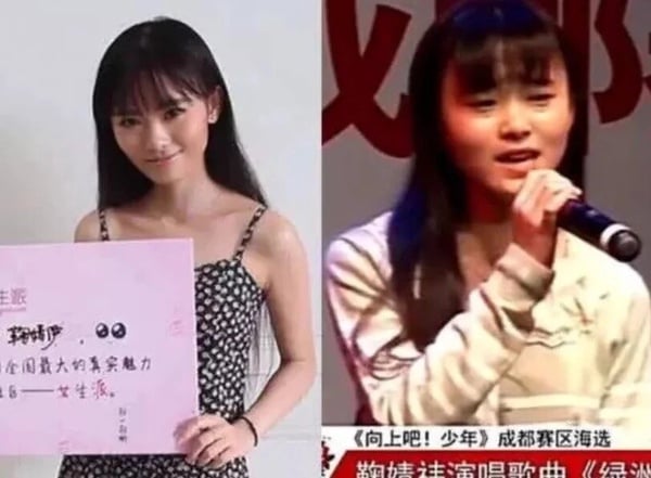 8位被質疑動臉的女星對比照!趙露思大方回應了,王楚然、楊紫都被懷疑過!