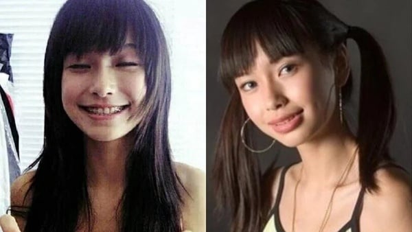 8位被質疑動臉的女星對比照!趙露思大方回應了,王楚然、楊紫都被懷疑過!