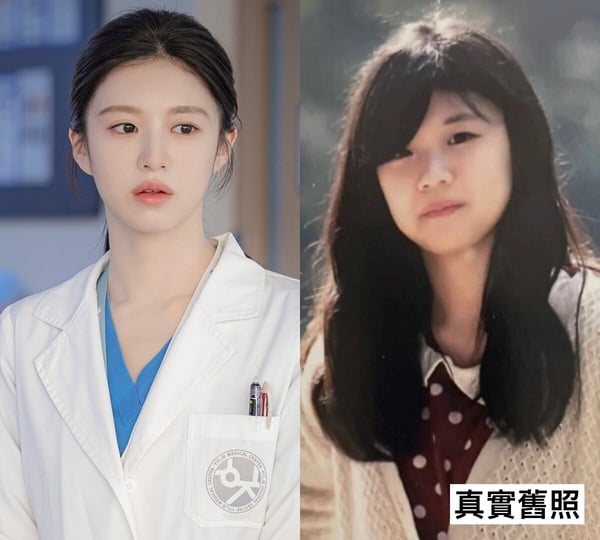《機智住院醫生》高允貞陷整形爭議？韓劇10女星舊照，韓志旼宋慧喬沒變，IU現在美多了