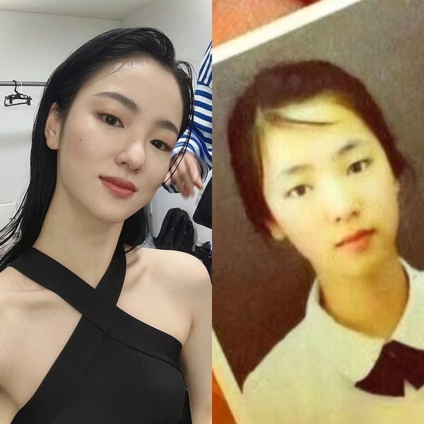 《機智住院醫生》高允貞陷整形爭議？韓劇10女星舊照，韓志旼宋慧喬沒變，IU現在美多了