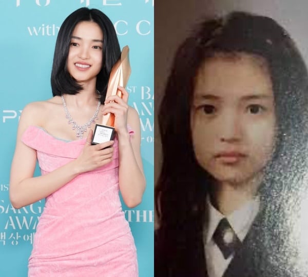 《機智住院醫生》高允貞陷整形爭議？韓劇10女星舊照，韓志旼宋慧喬沒變，IU現在美多了