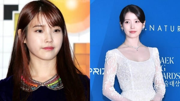 8位韓星「減肥前後」大對比！TWICE志效、T.O.P、GD以前都曾肉嘟嘟~公開瘦身方法！