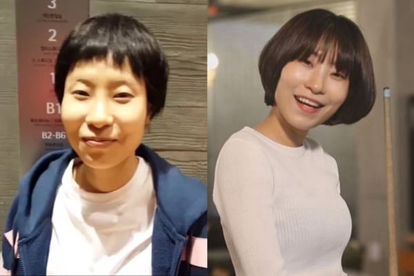 搞笑諧星李世英在《SNL》節目中的誇張表情，展現其不計形象的喜劇演出，但也因外貌遭受網路霸凌。