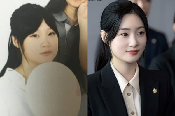 10位整形成功韓星：《夢想成為律師》鄭彩娟成「秀智接班人」，李世英花1億變性感女神