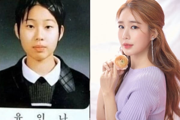 10位整形成功韓星：《夢想成為律師》鄭彩娟成「秀智接班人」，李世英花1億變性感女神