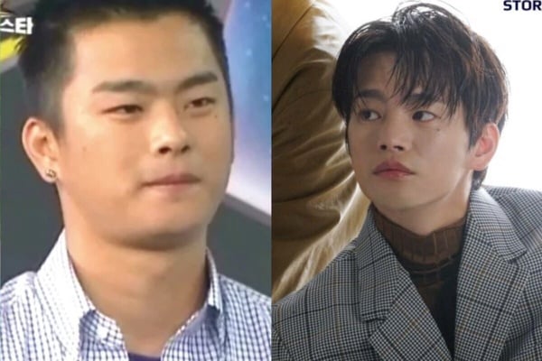 10位整形成功韓星：《夢想成為律師》鄭彩娟成「秀智接班人」，李世英花1億變性感女神