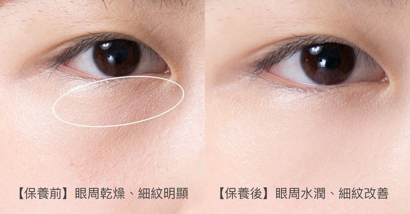 擦眼霜不再浪費錢!資生堂全新「小紅電眼精華」有感彈嫩亮Eye放電,聯手小紅瓶10倍年輕