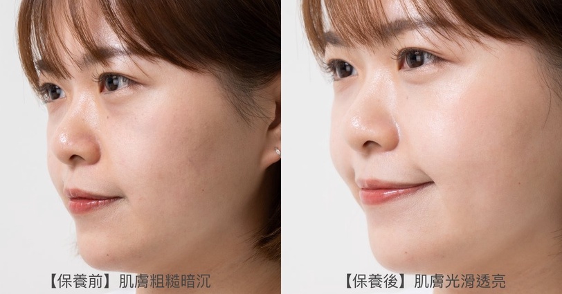 台酒生技VINATA 激透光米植醇特潤膠囊 密集美白精華液 密集美白乳液 超粹小金心