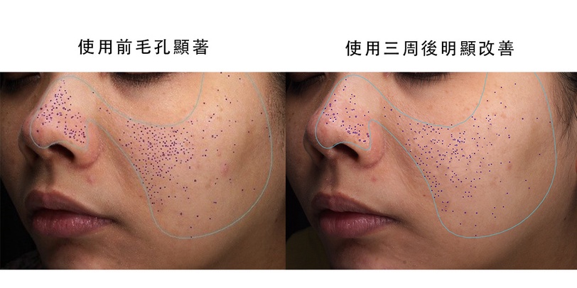 寵粉無上限讓你先試用再買！契爾氏【A醇全能新生抗痕精華】免費體驗7天，不滿意立即退