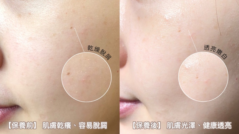 寶可夢迷必收！理膚寶水B5萬用霜X寶可夢聯名，一支收服乾燥脫屑、痘疤瑕疵、敏感泛紅!