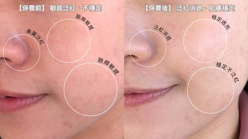 寶可夢迷必收！理膚寶水B5萬用霜X寶可夢聯名，一支收服乾燥脫屑、痘疤瑕疵、敏感泛紅!