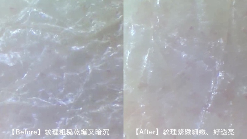 過年晉升臉蛋天才！專櫃精華液B編淚推資生堂小紅瓶，實測彈嫩亮，新年買這組最甜