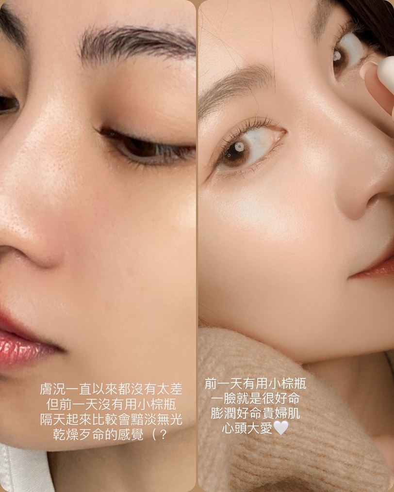 超狂美肌補給CP！「小棕瓶ｘ無敵霜」雙倍膠原Q彈，再造澎潤女神光
