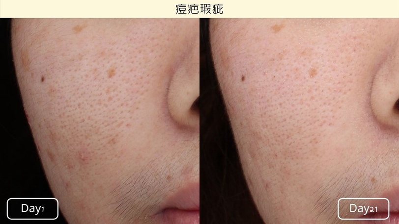 熬夜手機滑不停、滑出灰灰臉？網友0護航真實檢測「亮白氧氣瓶」透亮度激增18%最狂！