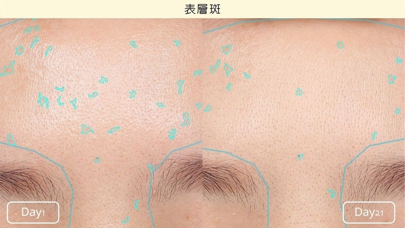 熬夜手機滑不停、滑出灰灰臉？網友0護航真實檢測「亮白氧氣瓶」透亮度激增18%最狂！