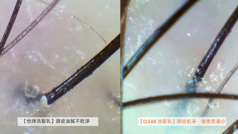 頭皮沒養好,洗頭也是白搭!實測CLEAR新升級去屑洗髮 10X護膚級成分添加,28天終結頭皮屑