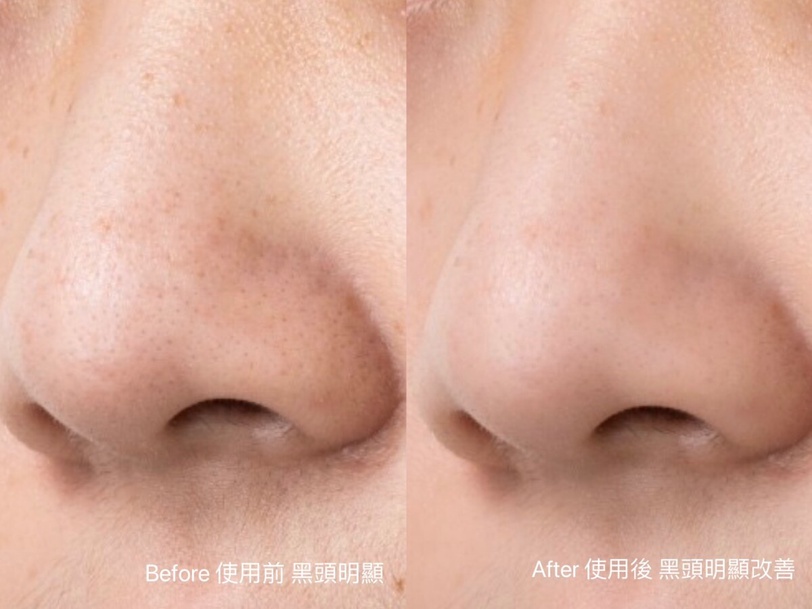 APRILSKIN 韓國洗卸斷貨王 胡蘿蔔IPMP深層潔淨卸妝霜 胡蘿蔔賦活調理精華