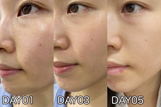 CLARINS 克蘭詩 雙激萃精華 彈簧霜