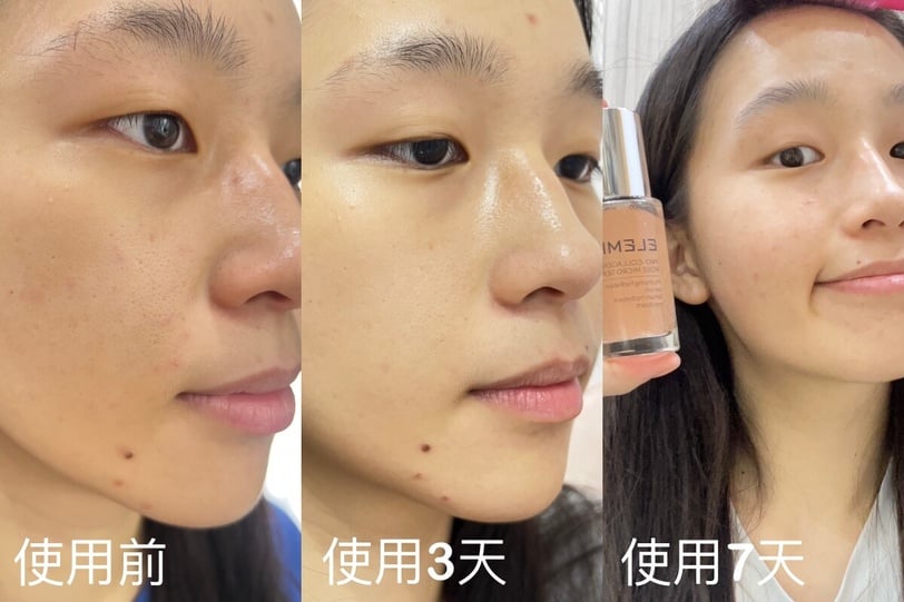 網友實測有顏有才！ELEMIS #澎澎小瑰蜜一抹柔嫩發光，保濕力3X進化，入秋美肌神隊友！