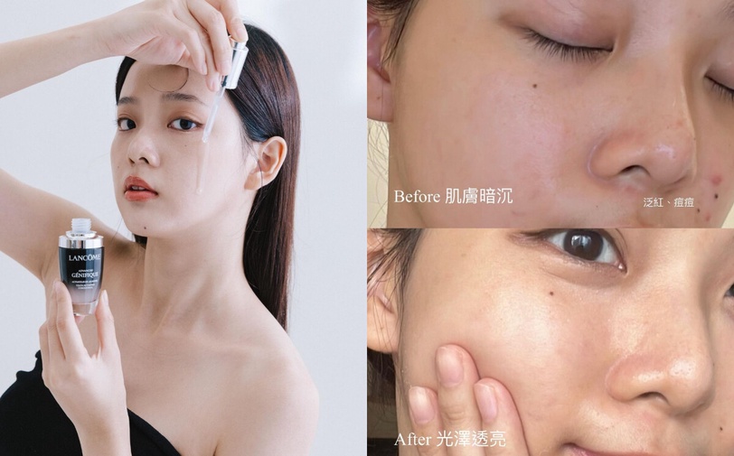 換季穩膚全效王者！蘭蔻小黑瓶由內而外修護強韌，擊退肌膚水逆，穩穩度過換季亂流！
