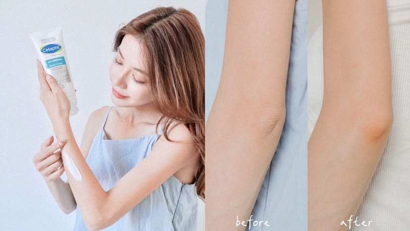 敏弱肌救星舒特膚怎麼選？醫級修護必收全新AD乳霜，網紅媽咪淚推立即舒緩乾癢長效保濕