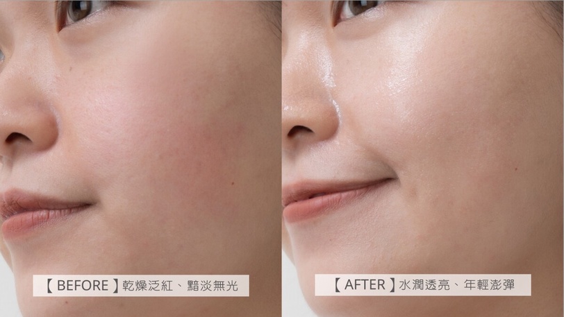 理膚寶水 B5小藍瓶 AB小紅瓶