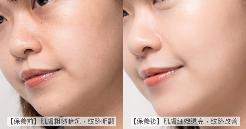 新一代A醇爆款「雙AA醇小粉膠」!早A晚A 10倍撫紋抗老,7天給你嫩亮燈泡肌,母檔無痛入手