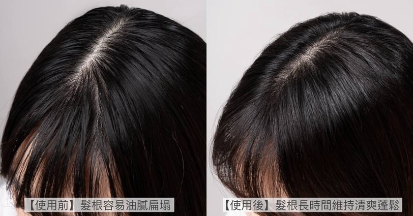 油頭養髮不怕扁塌!森歐黎漾質進化咖啡因系列控油生力軍,讓頭皮清爽,強韌髮根,豐盈有感