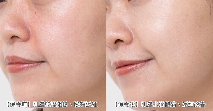 換季「紅臉女孩」逆襲看這篇！保濕修護養出健康水嫩肌，日常保養最強穩膚修護組合！