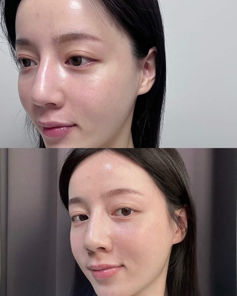 心動！光澤皮膚保養專家開啟夏日美肌改造計畫！網友實測肌膚嫩到發光，全膚質友善！