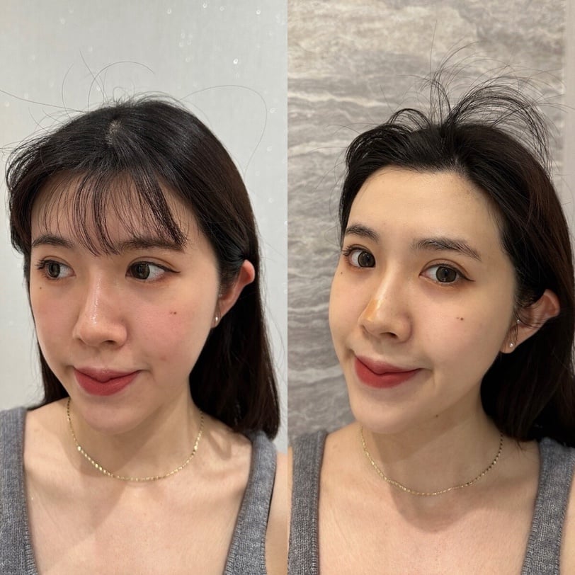 心動！光澤皮膚保養專家開啟夏日美肌改造計畫！網友實測肌膚嫩到發光，全膚質友善！