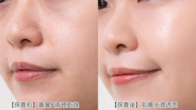 曬後修護超有感！炎夏穩膚兩招，先鎮定後修護、養回嫩亮燈泡肌，編輯圈讚爆！