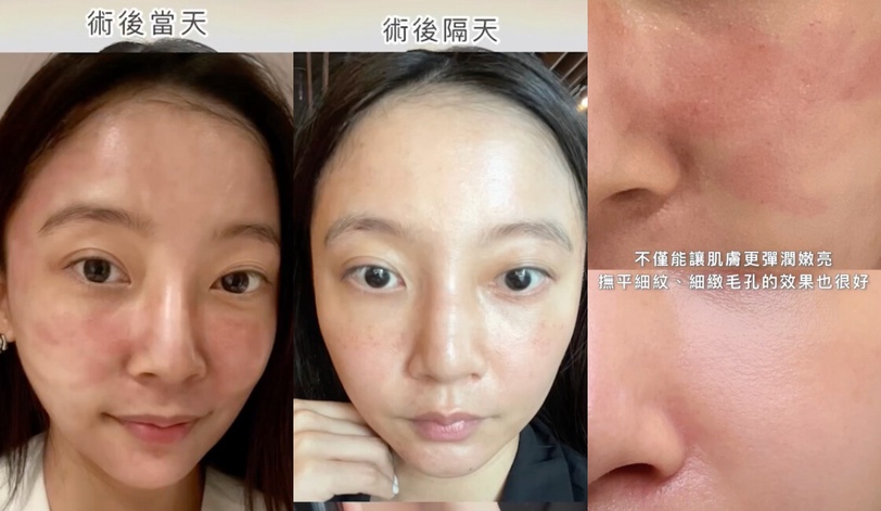 2024最注目抗老精華：蘭蔻全新「小黑瓶PRO」！楊祐寧愛不釋手的年輕秘訣一次公開！