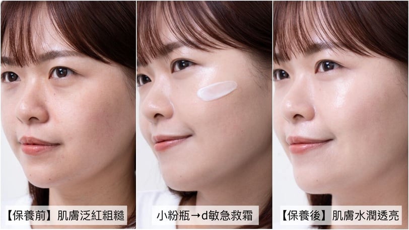 如何有效改善肌膚泛紅問題？敏感肌泛紅急救完整教學