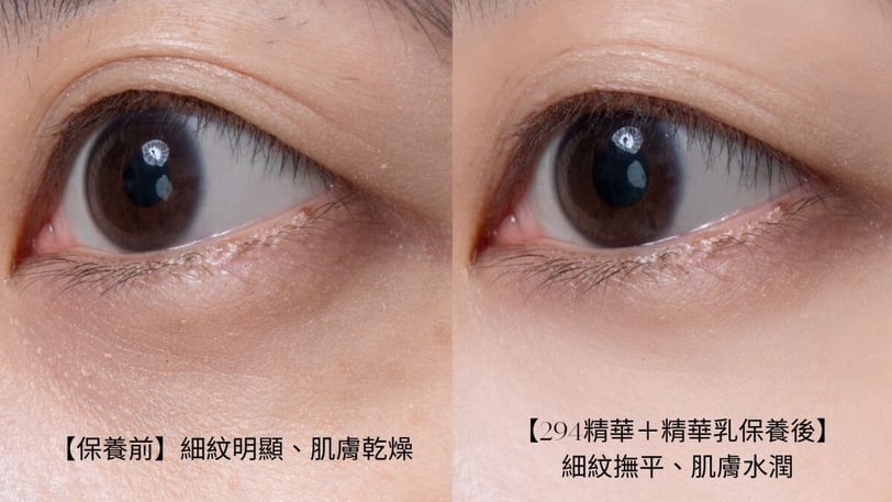臉垮了還有救！日本熱銷490萬瓶「DHC胜肽抗老」膠原複利成長，蘋果肌&amp;amp;amp;下顎線回歸超狂