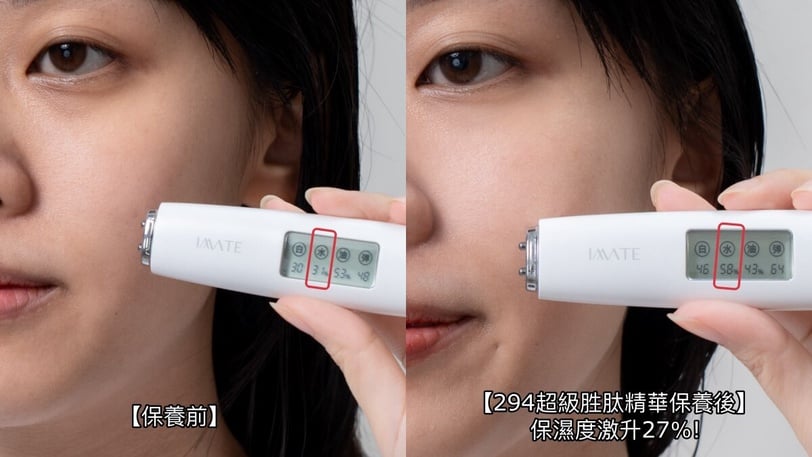 臉垮了還有救！日本熱銷490萬瓶「DHC胜肽抗老」膠原複利成長，蘋果肌&amp;amp;amp;下顎線回歸超狂