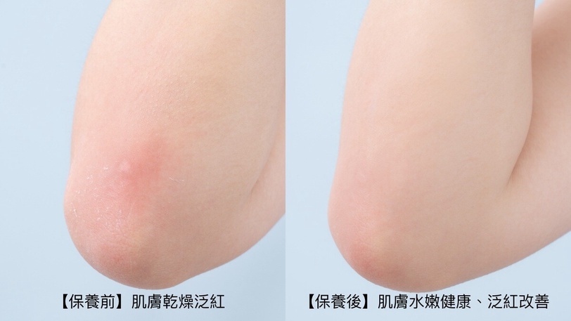 好市多超夯限量身體乳！修復敏弱乾癢肌膚，皮膚科醫生也大推！加一招K.O 5大敏感問題