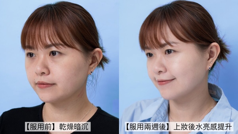韓妞水光作弊神器！「吃的爆水膠囊」一顆95%玻尿酸衝破保濕天花板，臉蛋嫩到掐出水