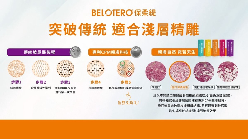 玻尿酸新突破，保柔緹自然不饅化！維昕診所愛用，獨家親膚科技不留痕好自在