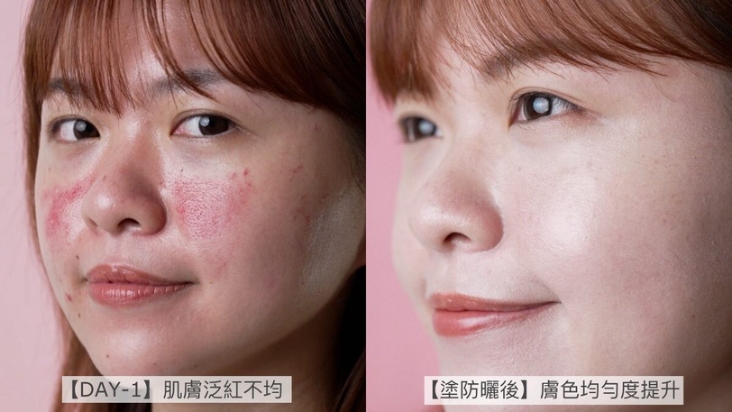 美容進廠後的天選防曬！B編實測打完雷射用這瓶防曬，預防反黑無死角，安心度過修復期